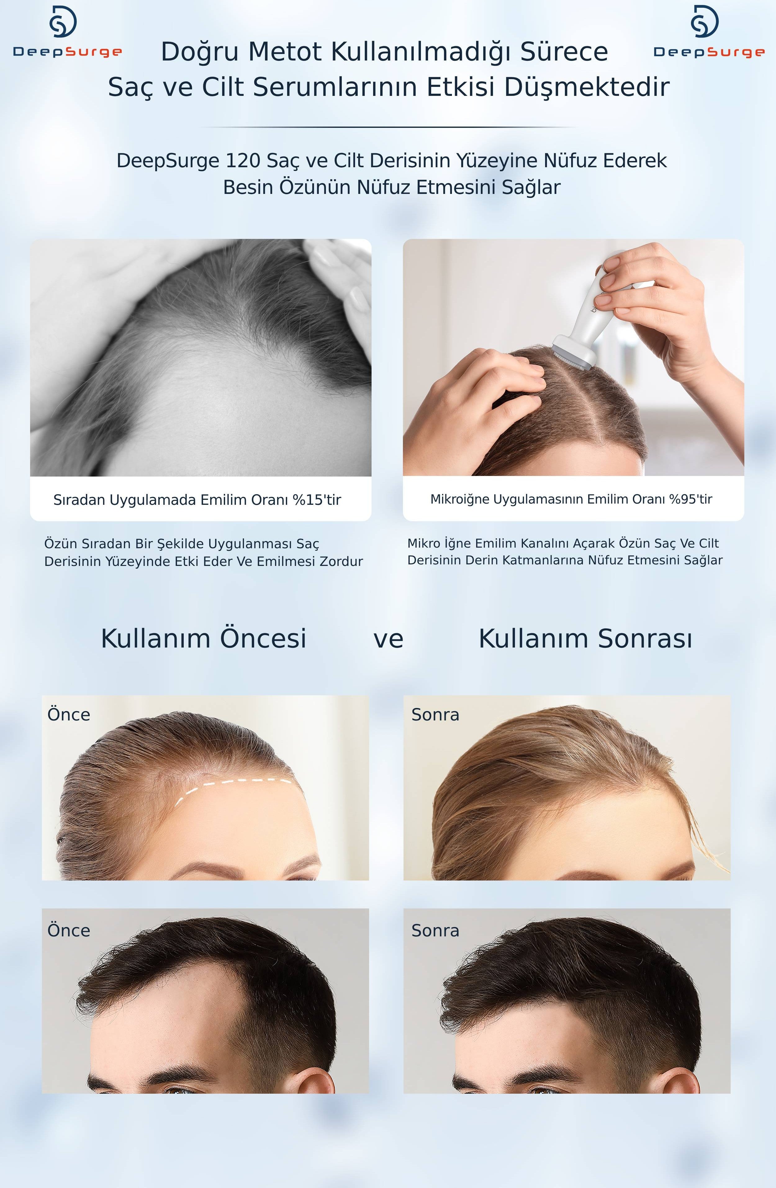 Ayarlanabilir İğne Ölçülü Derma Stamp