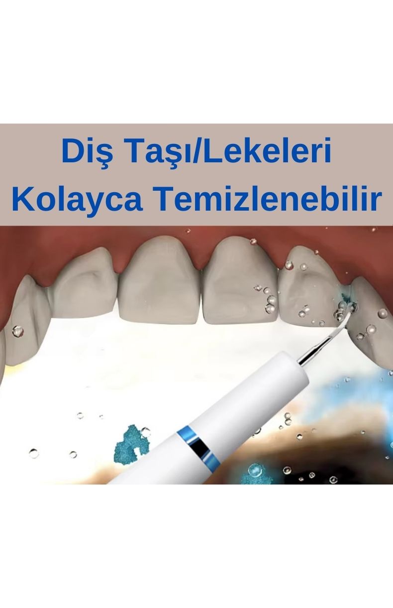 DS1 Şarjlı Diş Taşı Temizleme Cihazı