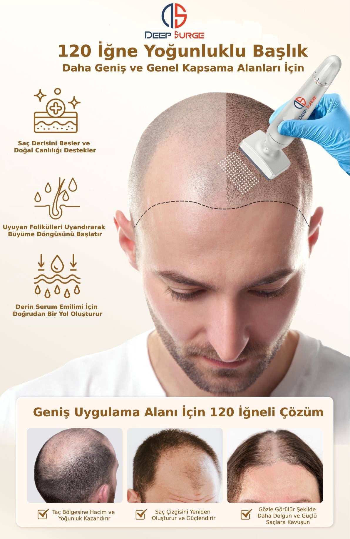 Değiştirilebilir Başlıklı Ayarlanabilir Titanyum İğne Ölçülü Dermastamp