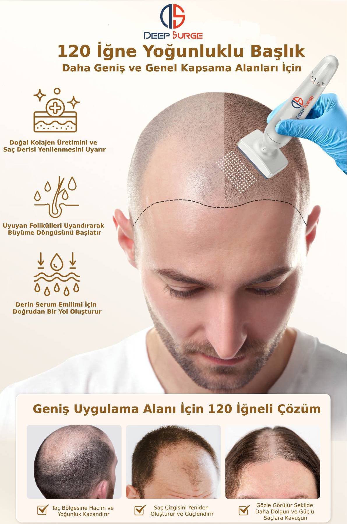 Değiştirilebilir Başlıklı Ayarlanabilir Titanyum İğne Ölçülü Dermastamp