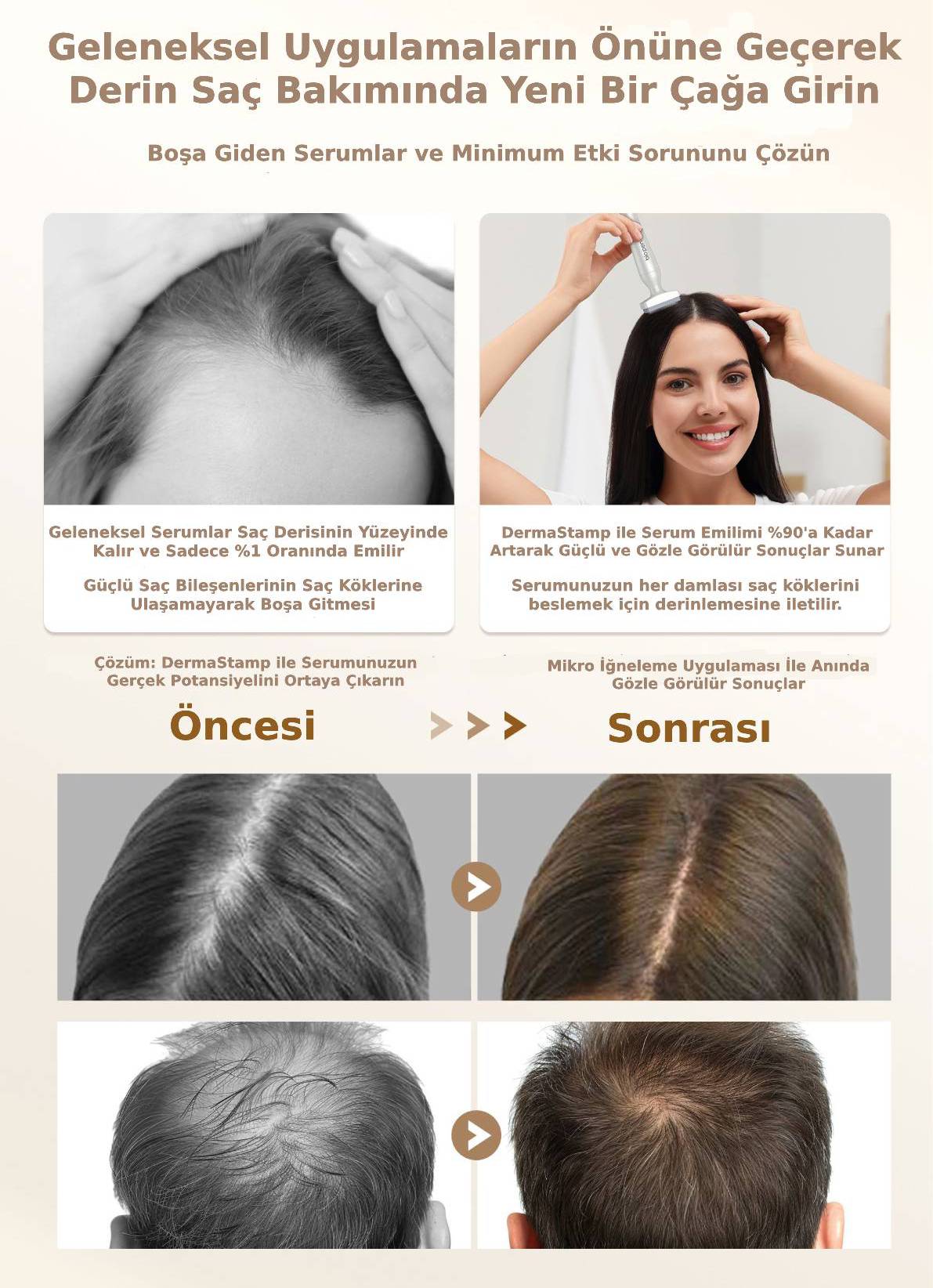 Değiştirilebilir Başlıklı Ayarlanabilir Titanyum İğne Ölçülü Dermastamp